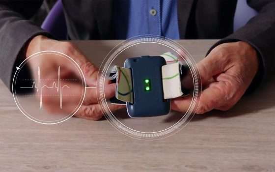 Nightwatch, un bracciale smart contro l'epilessia