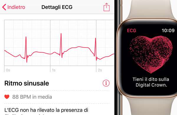 La funzionalità ECG di Apple Watch Series 4