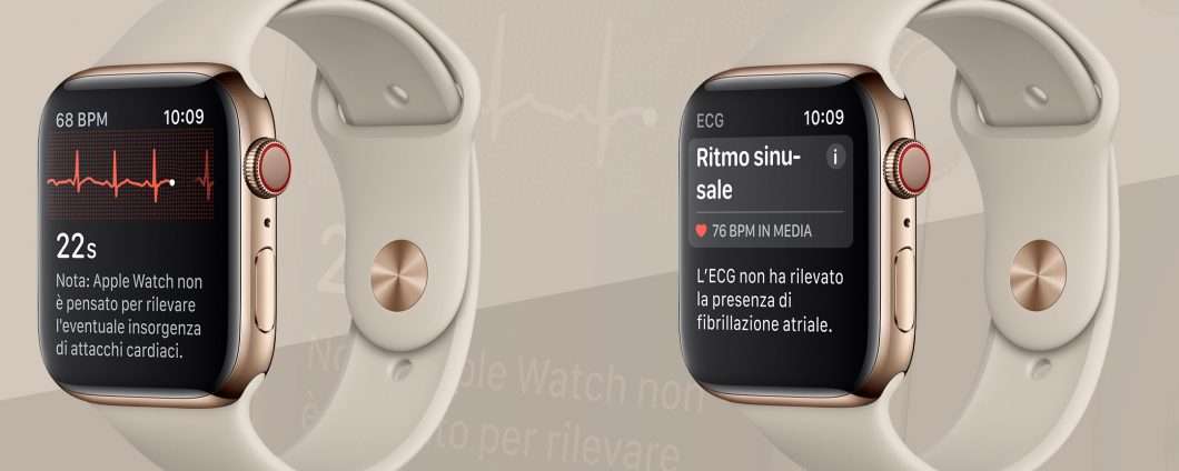 La fibrillazione atriale rilevata da Apple Watch