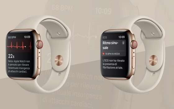 La fibrillazione atriale rilevata da Apple Watch
