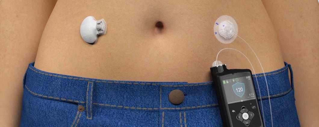 Rischio sicurezza per pompe insuliniche Medtronic