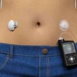 Rischio sicurezza per pompe insuliniche Medtronic