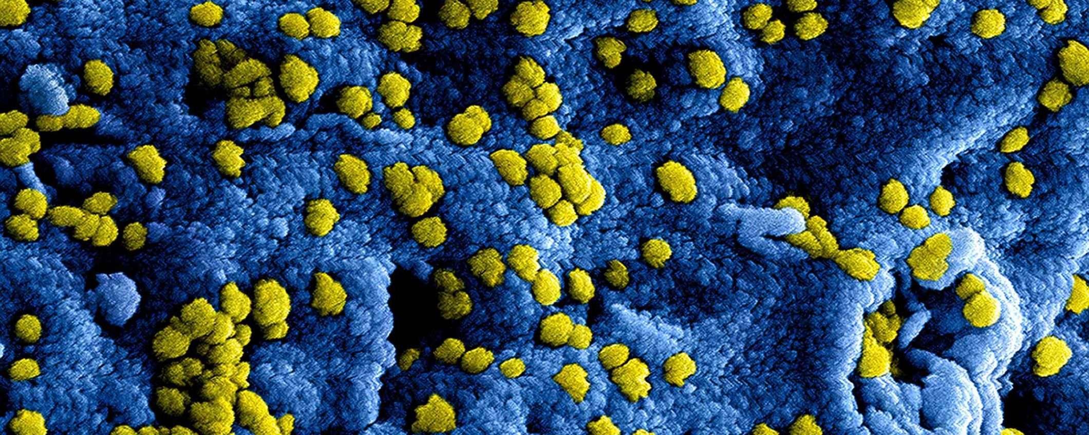 Coronavirus: aggiornamenti, fonti e risorse per seguire l'evoluzione dell'epidemia