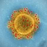 Coronavirus, le parole sono importanti: pandemia