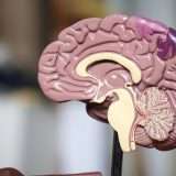 Da Intel un'IA contro il tumore al cervello