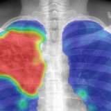 Tra 10 anni, i reparti di patologia saranno digitalizzati