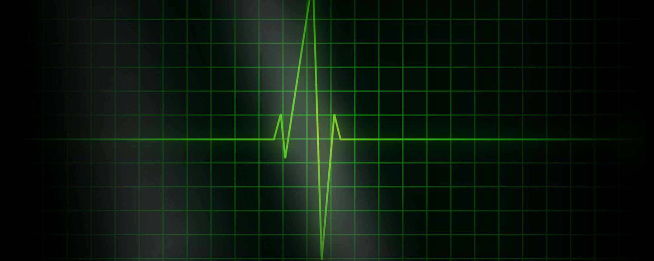 L'aritmia cardiaca si trova con un software