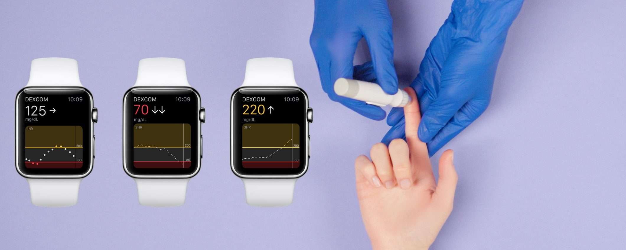 Come Apple Watch ha salvato la vita di un diabetico tipo 1
