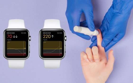 Come Apple Watch ha salvato la vita di un diabetico tipo 1