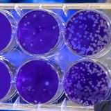 Scienziati scoprono nuovi antibiotici grazie all'AI