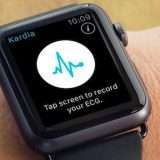 ECG con watchOS: Apple vince contro AliveCor