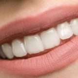 Polizza odontoiatrica per tutta la famiglia: ora c'è UniSalute Dentista