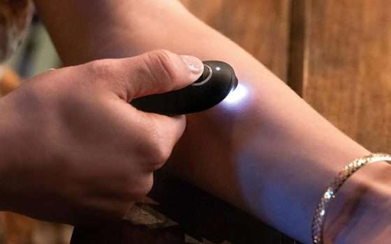 Dopopuntura per zanzare con LED: sollievo immediato in offerta