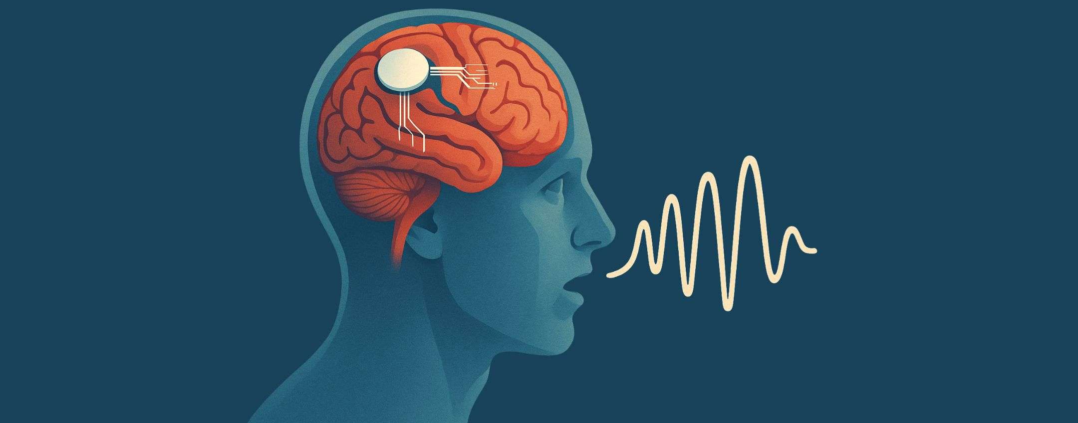 Neuralink di Elon Musk: presto potremo scrivere con il pensiero