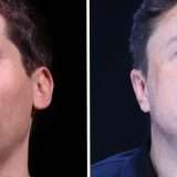 Elon Musk vs Sam Altman: terzo round