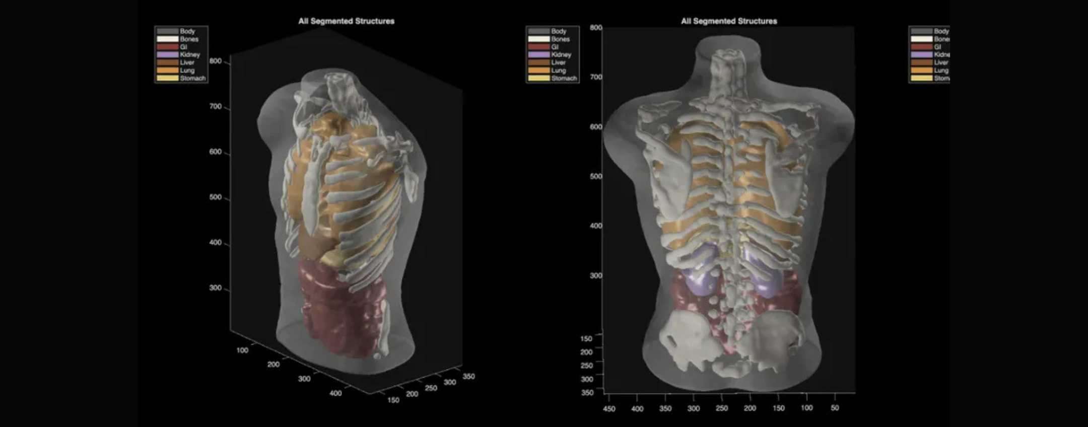 Scanner corporeo di Midjourney
