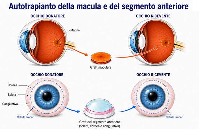 Come è avvenuta l'operazione