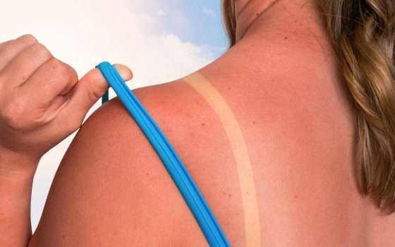 Una sola scottatura solare può cambiare per sempre la tua salute