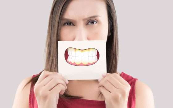 Placca dentale: i ricercatori hanno trovato un modo per fermarla