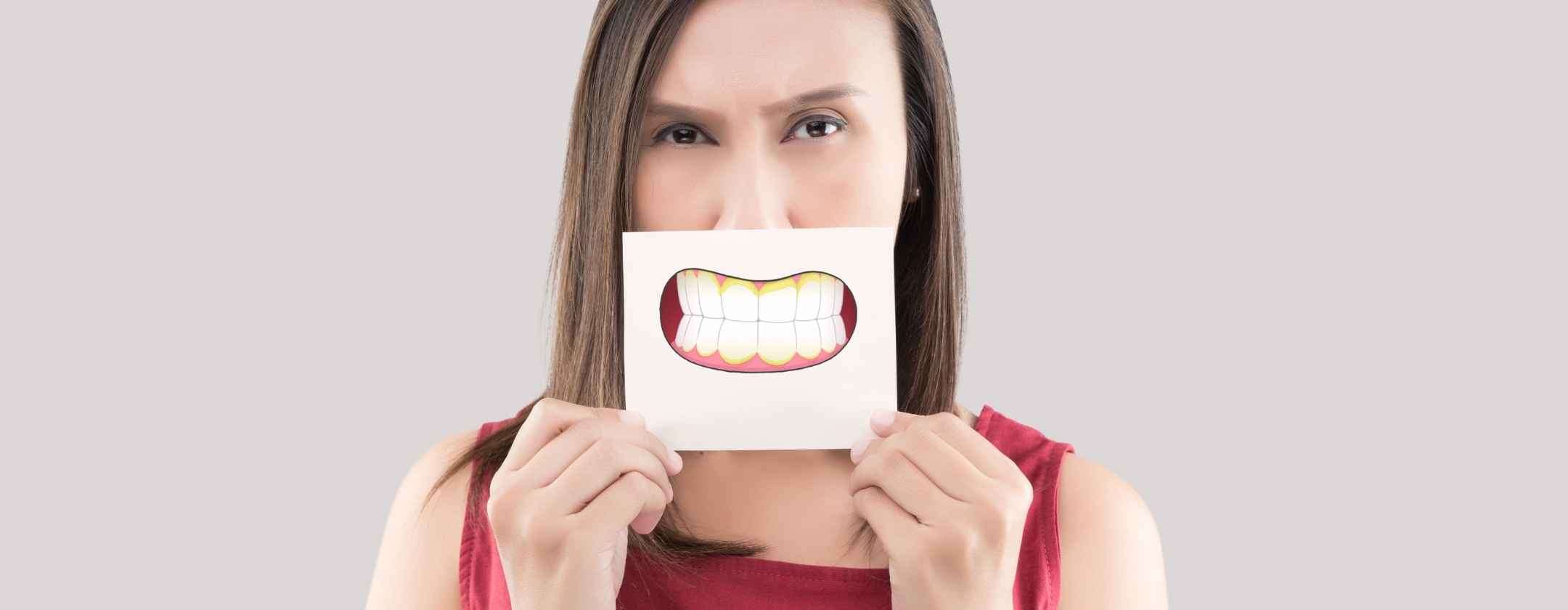 Placca dentale: i ricercatori hanno trovato un modo per fermarla
